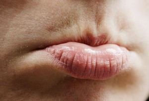 lips discoloration home remedies